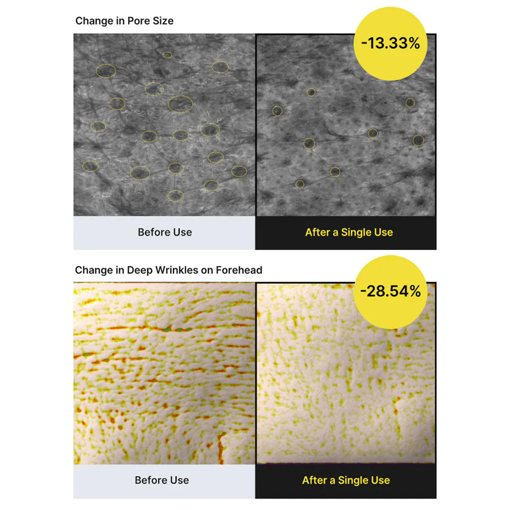 Celimax Retinal Shot Tighterning Booster