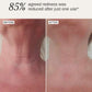Retinol Reboot Exfoliating Body Treatment