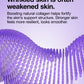 Clinique - Clinique Smart Clinical Repair Wrinkle Correcting Rich Cream - Very Dry to Dry - The Beauty Shop - 192333125113